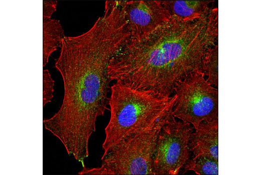  Image 23: LRP1-mediated Endocytosis and Transmission of Tau Antibody Sampler Kit