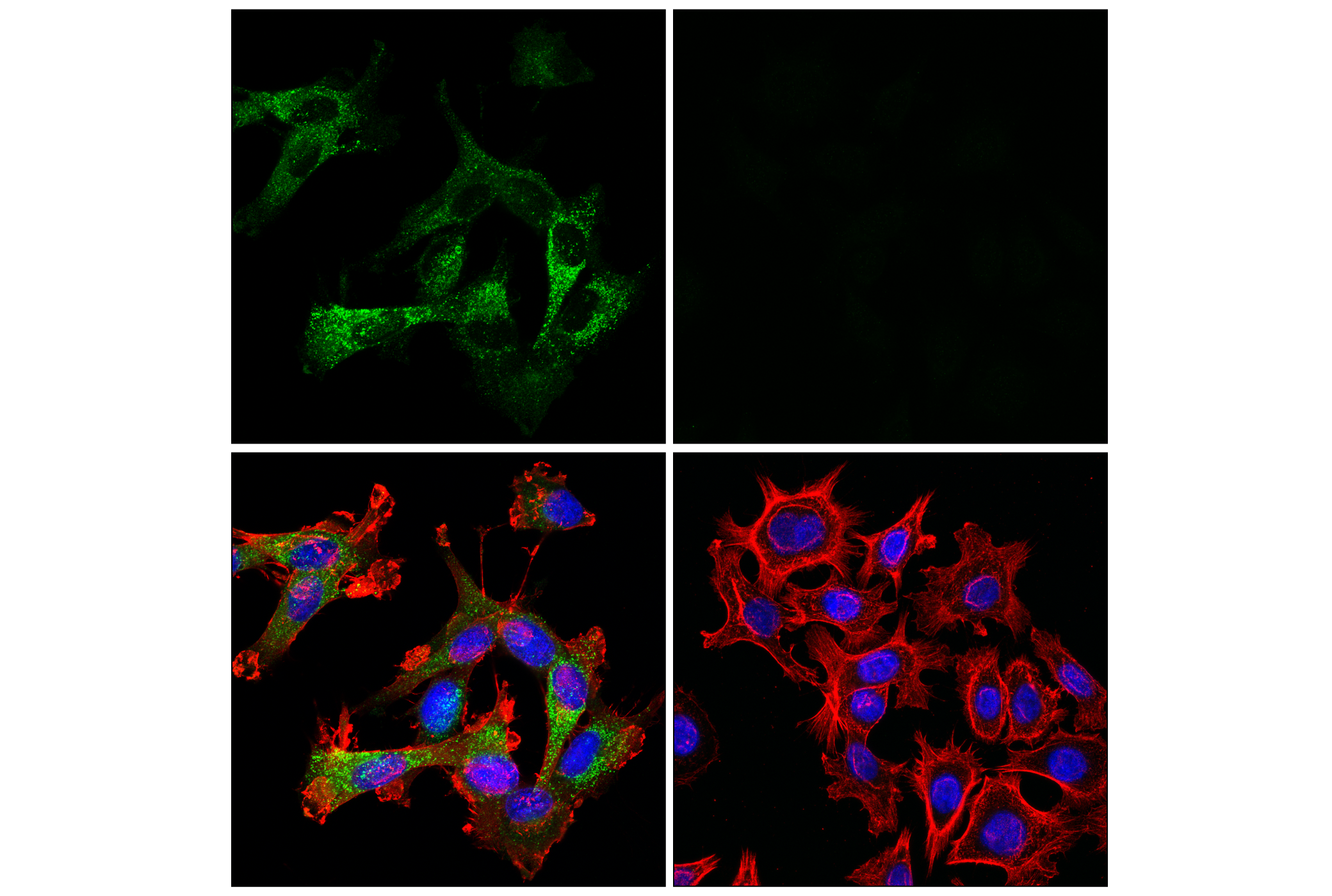 Immunofluorescence Image 1: Cathepsin L (E3R3P) Rabbit mAb