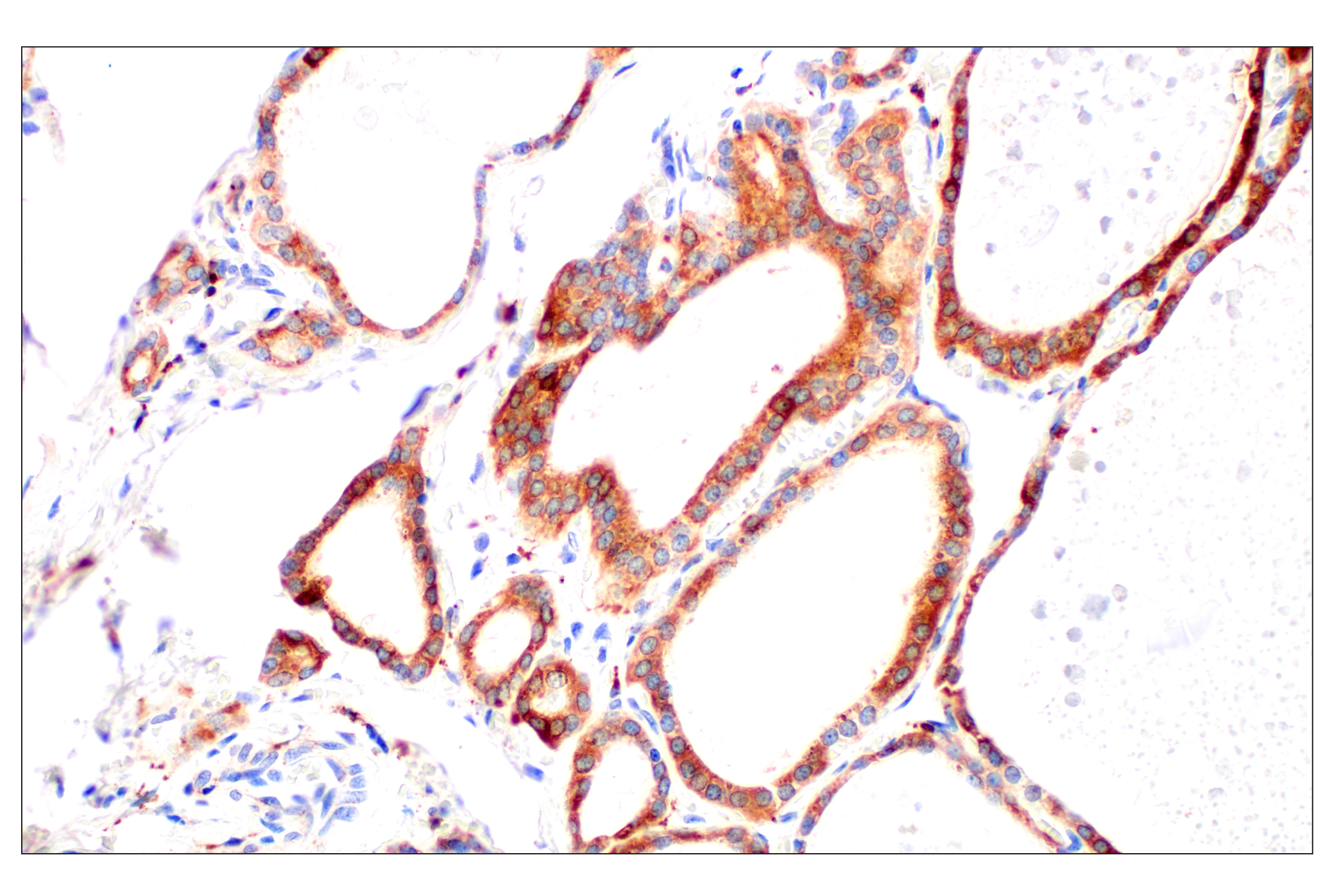 Immunohistochemistry Image 15: Cathepsin L (E3R3P) Rabbit mAb