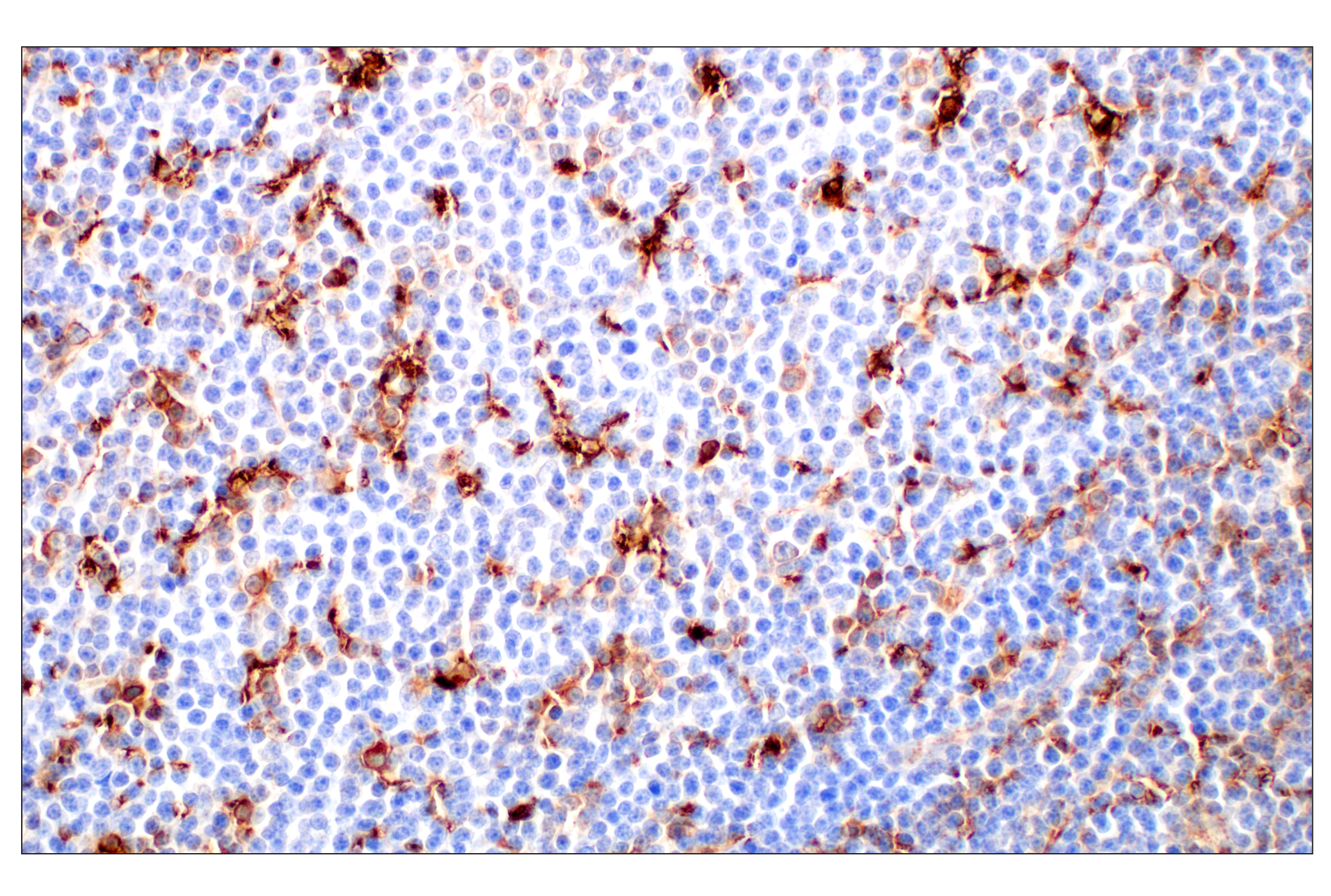 Immunohistochemistry Image 3: Cathepsin L (E3R3P) Rabbit mAb