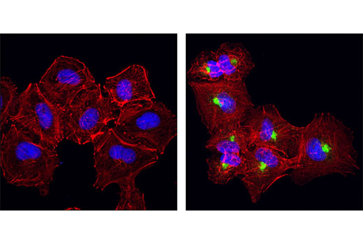 Immunofluorescence Image 1: βIG-H3 (D31B8) XP® Rabbit mAb