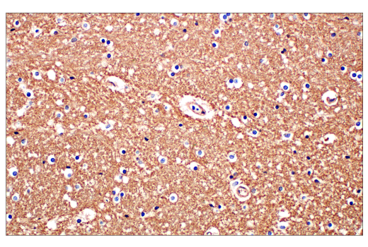 Immunohistochemistry Image 9: CD81 (D3N2D) Rabbit mAb