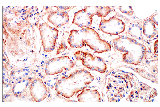 Immunohistochemistry Image 8: CD81 (D3N2D) Rabbit mAb