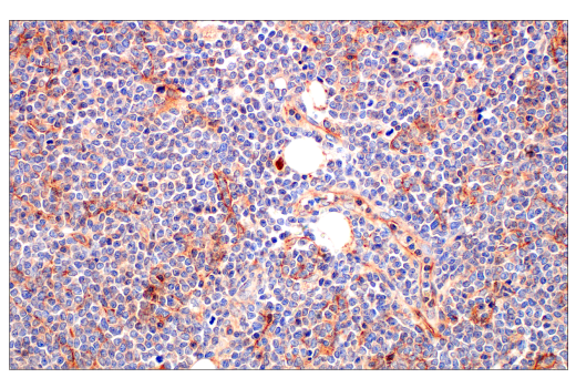Immunohistochemistry Image 5: CD81 (D3N2D) Rabbit mAb