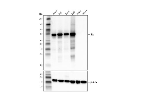 Western Blotting Image 1: Btk (D6T2C) Mouse mAb (BSA and Azide Free)