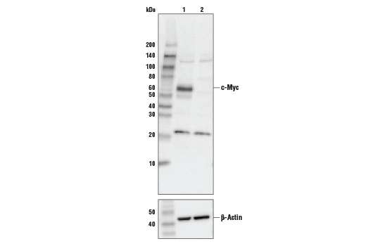  Image 11: Wnt/β-Catenin Activated Targets Antibody Sampler Kit