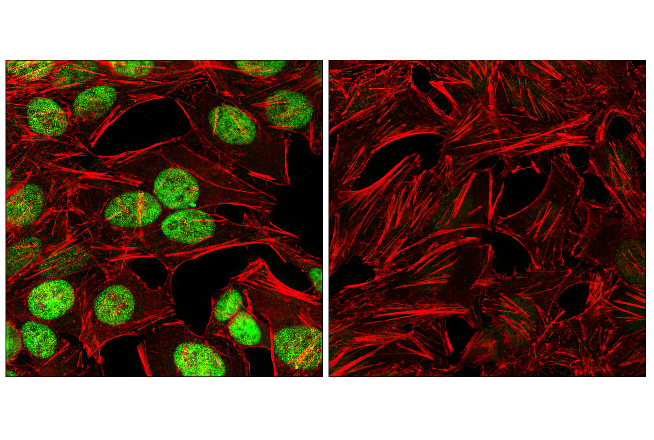 Immunofluorescence Image 1: c-Myc (D84C12) Rabbit mAb