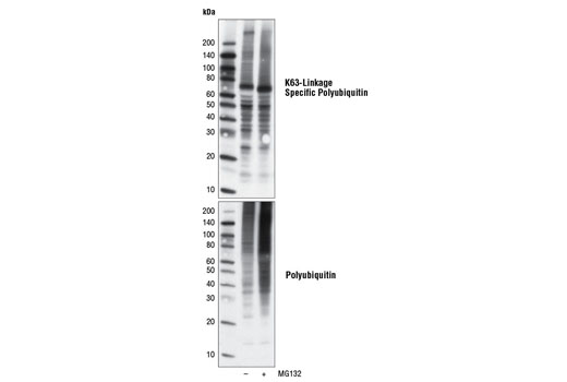 Western Blotting Image 1: K63-linkage Specific Polyubiquitin (D7A11) Rabbit mAb