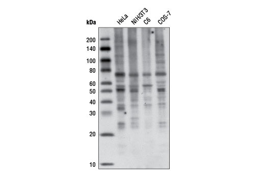Western Blotting Image 4: K63-linkage Specific Polyubiquitin (D7A11) Rabbit mAb