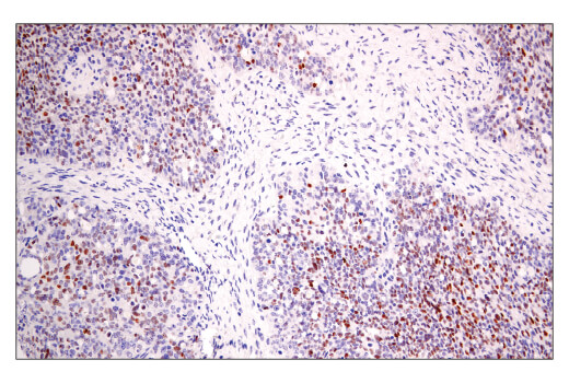Immunohistochemistry Image 5: BCL6 (E5I8I) Rabbit mAb (BSA and Azide Free)