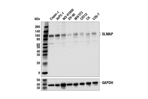 Western Blotting Image 1: SLMAP (E5F4Y) Rabbit mAb