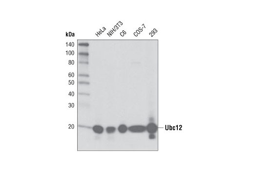 Western Blotting Image 1: Ubc12 (D13D7) Rabbit mAb