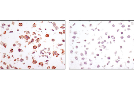 Immunohistochemistry Image 2: CA9 (D47G3) Rabbit mAb