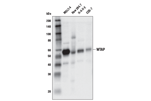 Image 3: N6-mA Methyltransferase Antibody Sampler Kit
