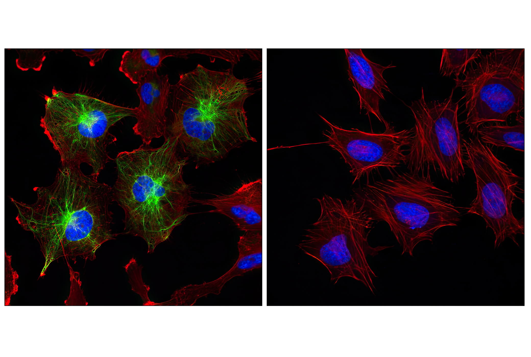 Immunofluorescence Image 2: GFAP (GA5) Mouse mAb (BSA and Azide Free)