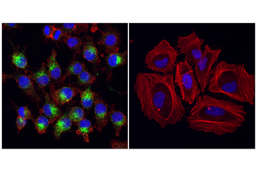 Immunofluorescence Image 2: VISTA (D5L5T) XP® Rabbit mAb (BSA and Azide Free)