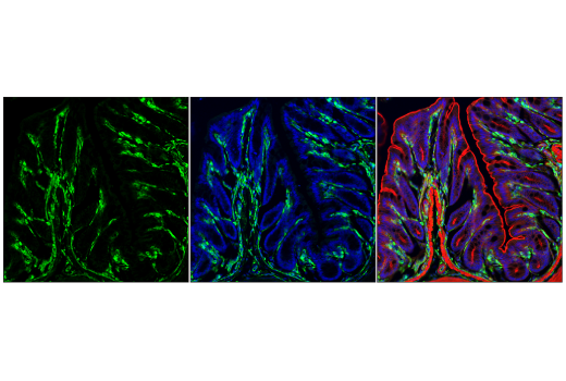 Immunofluorescence Image 1: VISTA (D5L5T) XP® Rabbit mAb (BSA and Azide Free)