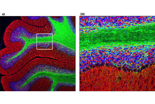  Image 11: Neuronal Marker IF Antibody Sampler Kit