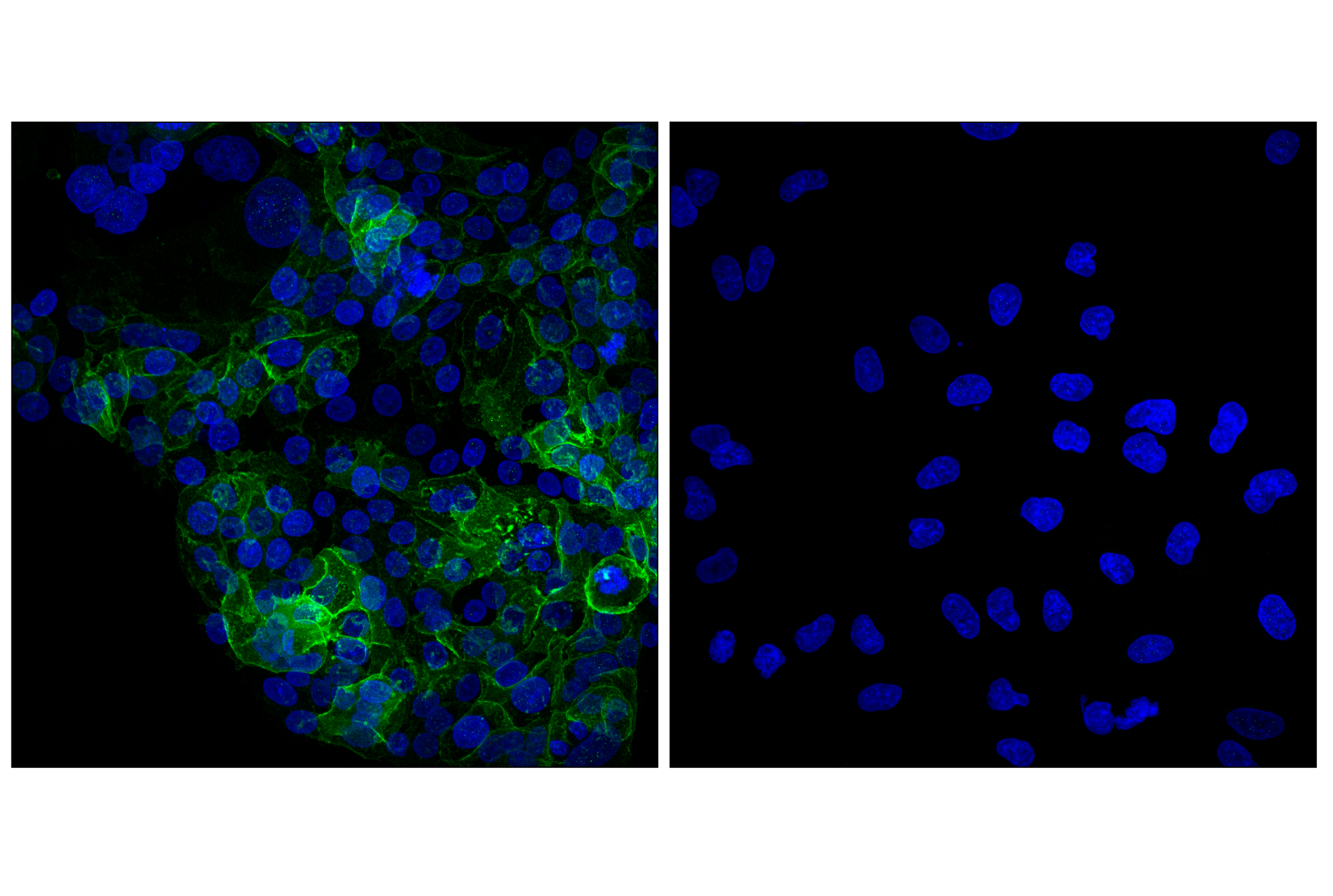  Image 28: Astrocyte Markers Antibody Sampler Kit