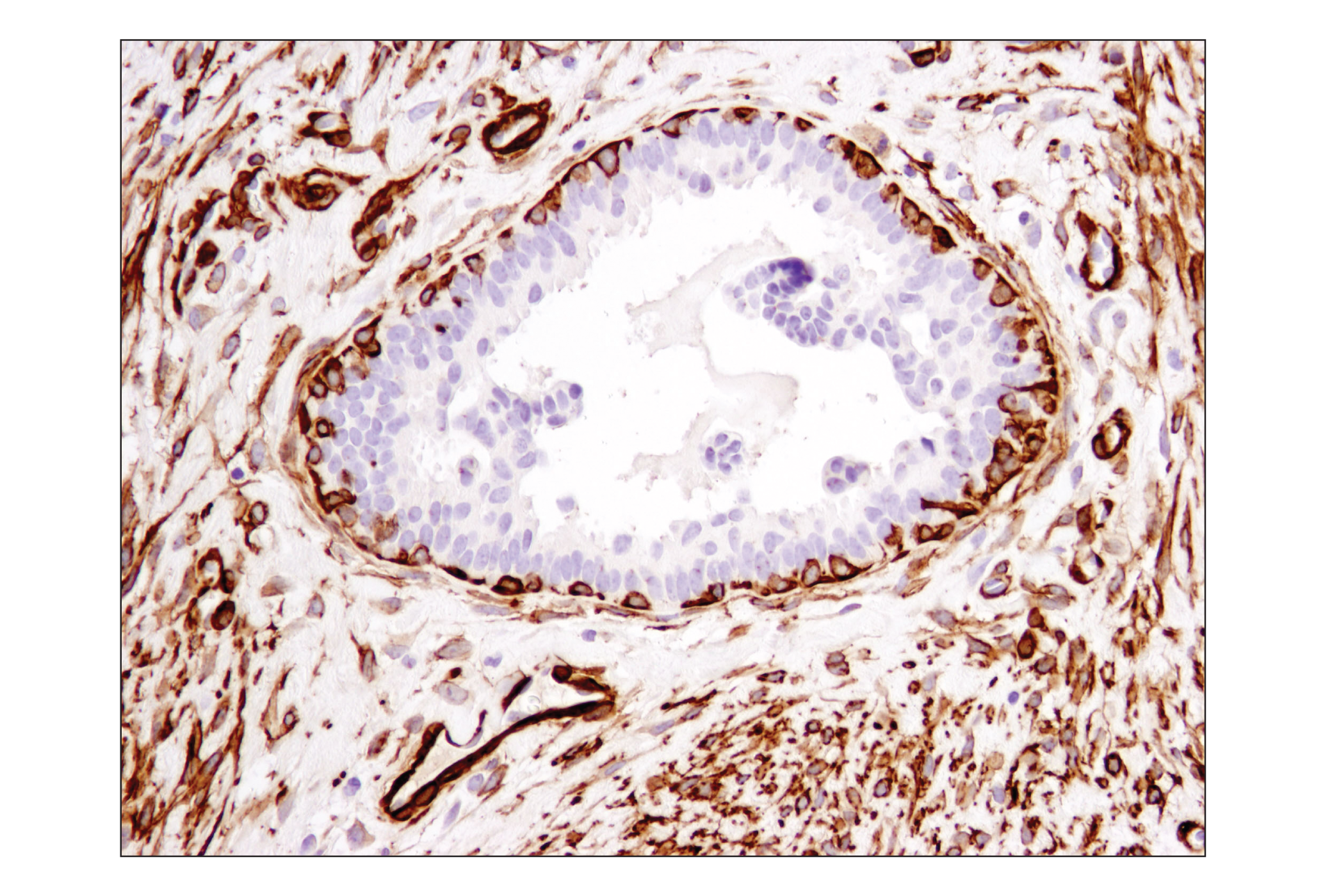 Immunohistochemistry Image 1: α-Smooth Muscle Actin (1A4) Mouse mAb (IHC Formulated)