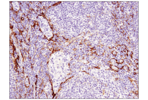 Immunohistochemistry Image 4: α-Smooth Muscle Actin (1A4) Mouse mAb (IHC Formulated)