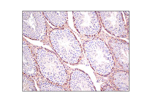  Image 40: TREM2 Signaling Pathways Antibody Sampler Kit