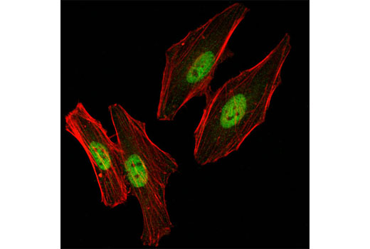 Immunofluorescence Image 1: SMC3 (D47B5) Rabbit mAb