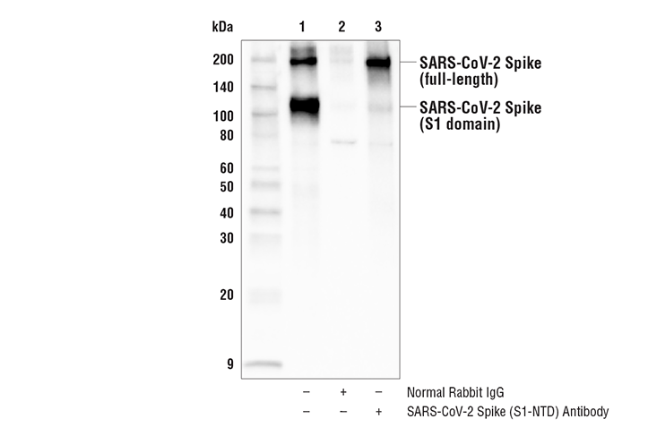 Immunoprecipitation Image 1: SARS-CoV-2 Spike Protein (S1-NTD) Antibody
