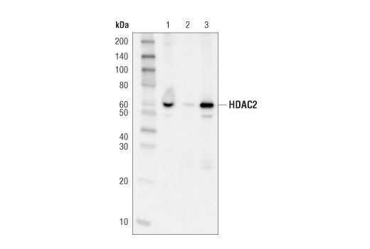  Image 8: Class I HDAC Antibody Sampler Kit