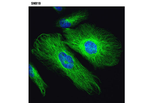  Image 40: Cancer Associated Fibroblast Marker Antibody Sampler Kit