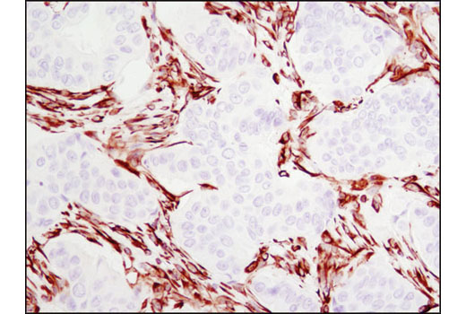  Image 34: Epithelial-Mesenchymal Transition (EMT) IF Antibody Sampler Kit