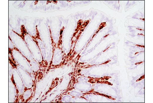  Image 18: Cell Fractionation Antibody Sampler Kit