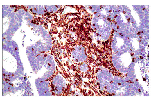  Image 17: Cell Fractionation Antibody Sampler Kit