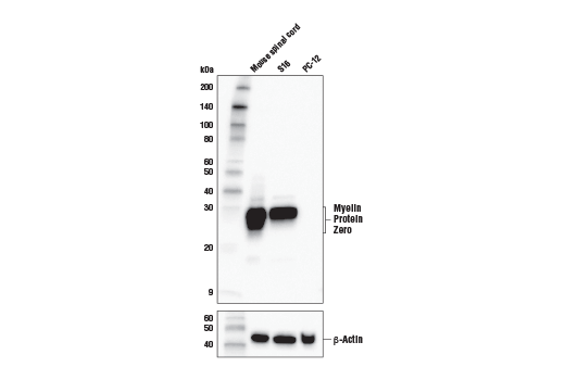 Western Blotting Image 1: Myelin Protein Zero Antibody