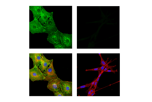 Immunofluorescence Image 2: Myelin Protein Zero Antibody