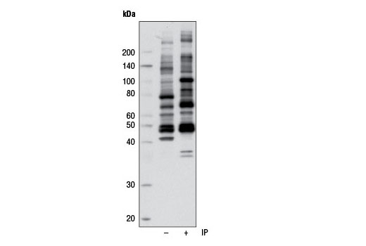 Immunoprecipitation Image 1: Phospho-AMPK Substrate Motif [LXRXX(pS/pT) MultiMab™ Rabbit mAb mix