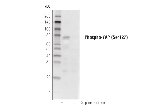 Phospho-YAP (Ser127) (D9W2I) Rabbit mAb | Cell Signaling Technology