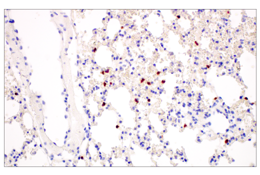 Immunohistochemistry Image 4: CD177 (E1V7N) Rabbit mAb (BSA and Azide Free)