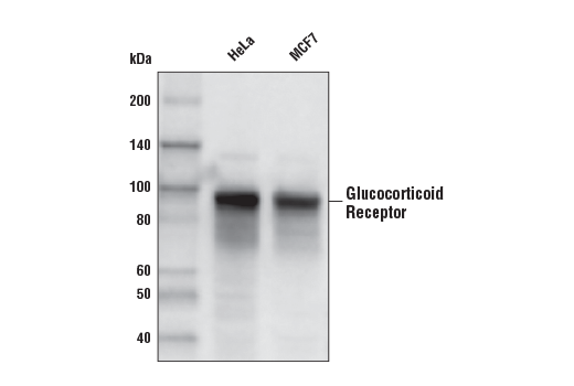 Western Blotting Image 1: Glucocorticoid Receptor (D6H2L) XP® Rabbit mAb (Biotinylated)