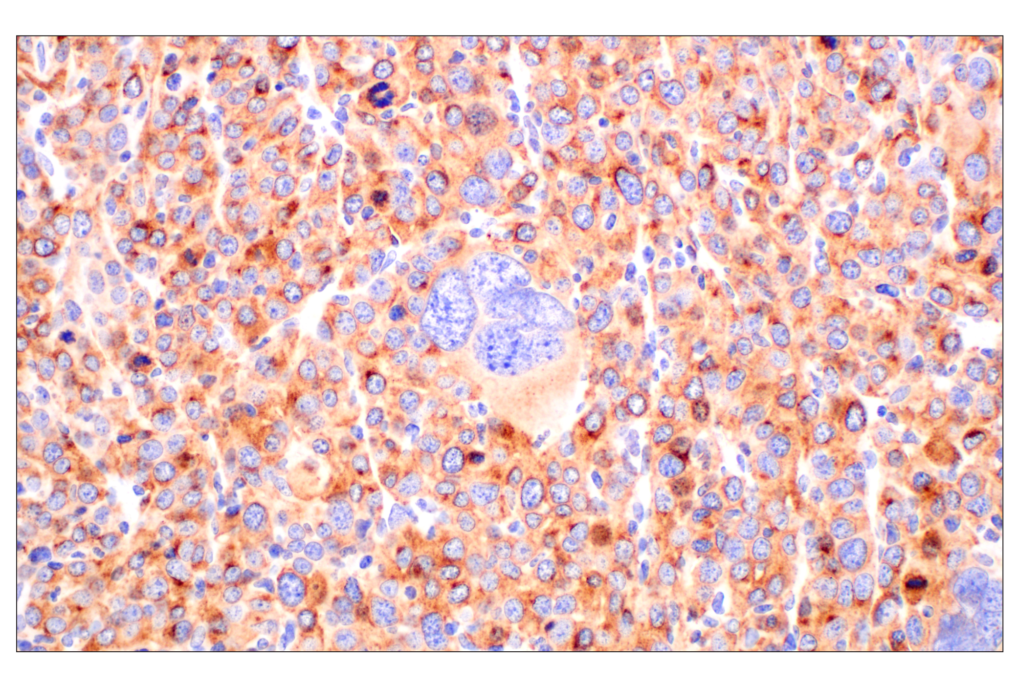 Immunohistochemistry Image 1: CD10/Neprilysin (F4P6H) Rabbit mAb