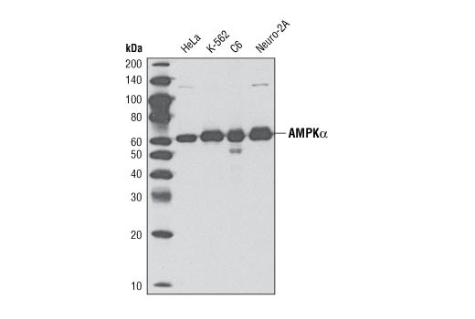  Image 6: ULK1 Antibody Sampler Kit