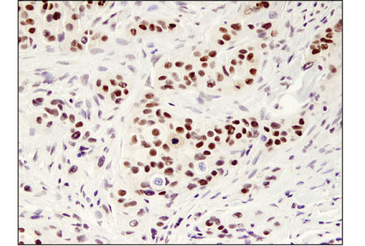 Immunohistochemistry Image 1: MYST2 (D4N3F) Rabbit mAb
