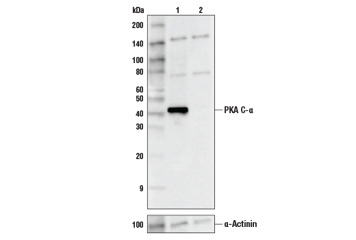  Image 4: Calcium Ion Regulation Antibody Sampler Kit