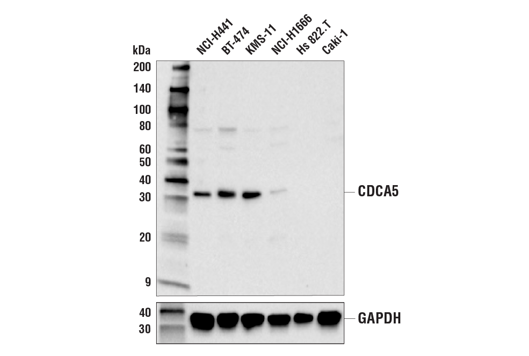 Western Blotting Image 1: CDCA5 Antibody