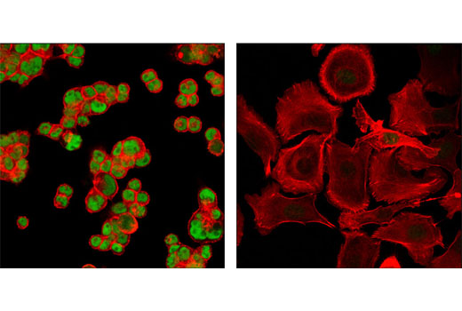  Image 11: Cardiogenesis Marker Antibody Sampler Kit