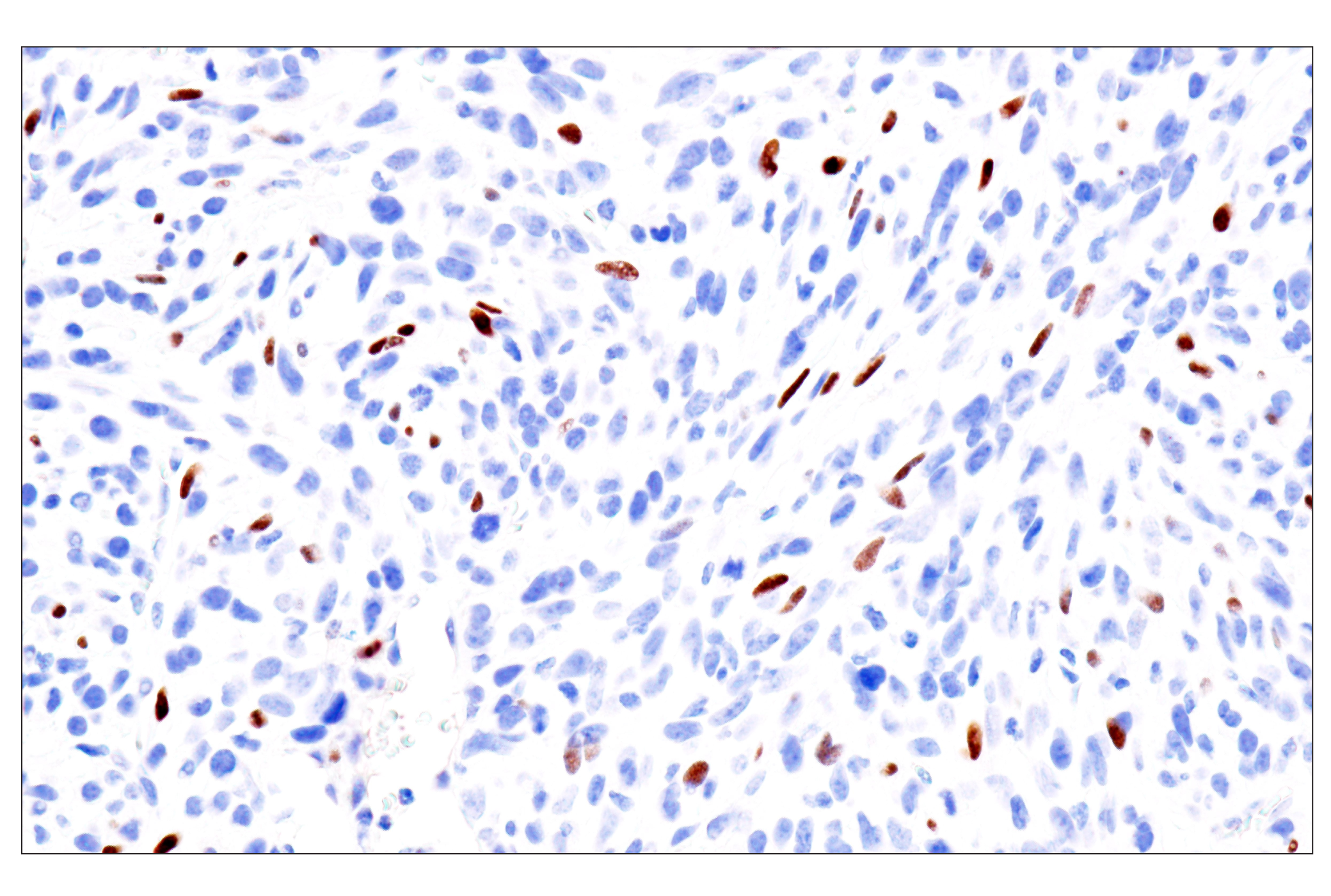  Image 44: Cardiogenesis Marker Antibody Sampler Kit