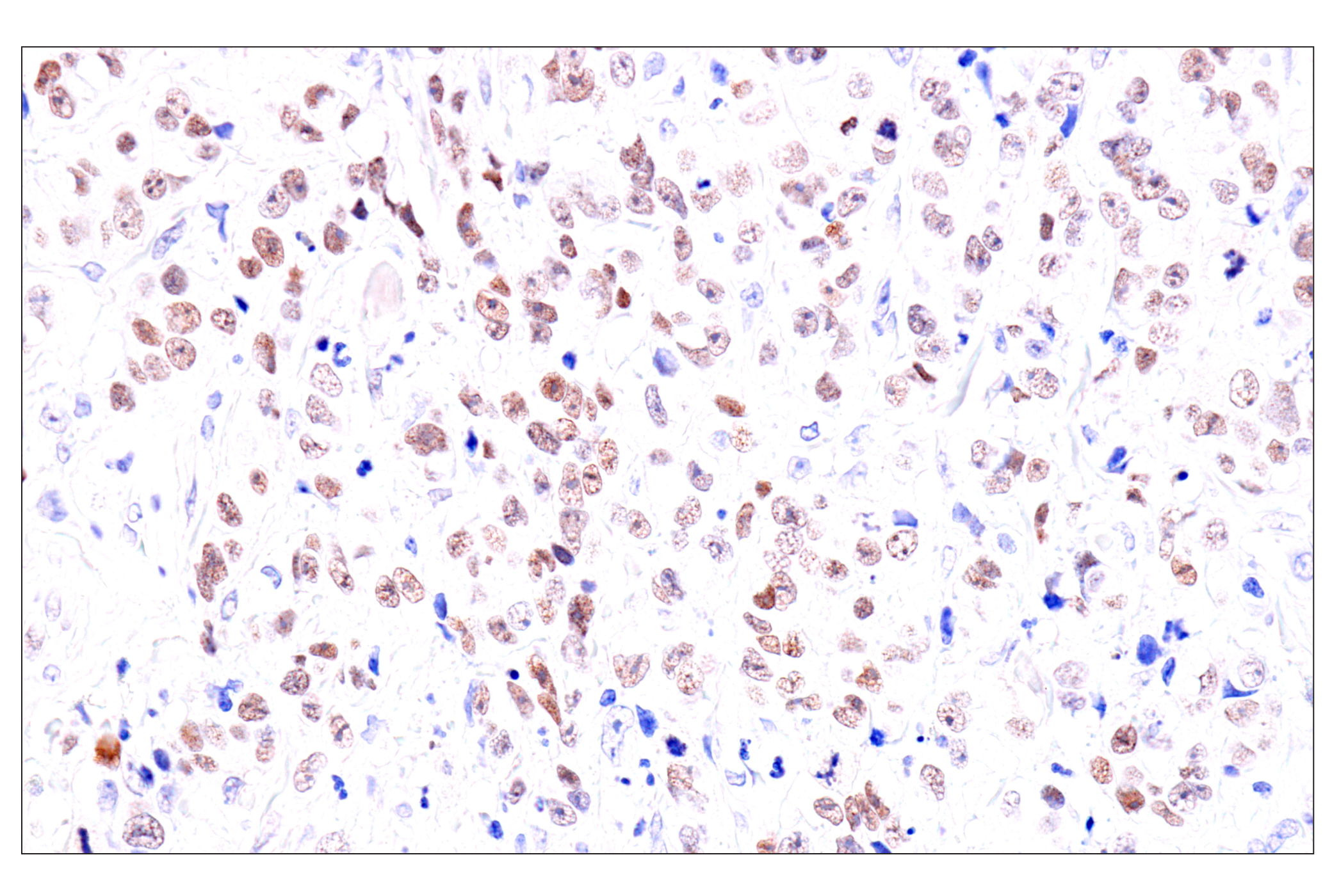  Image 30: Cardiogenesis Marker Antibody Sampler Kit
