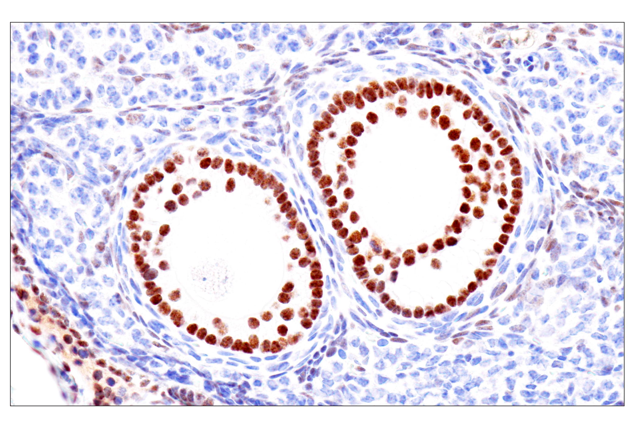  Image 46: Cardiogenesis Marker Antibody Sampler Kit