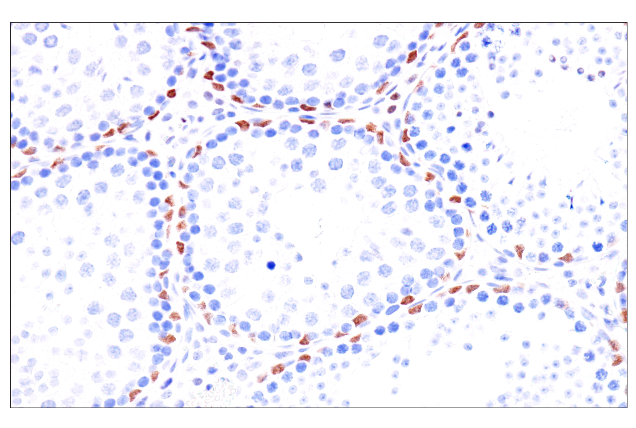  Image 45: Cardiogenesis Marker Antibody Sampler Kit