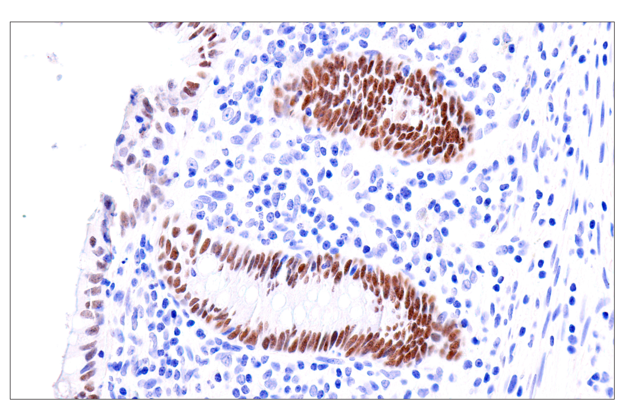  Image 41: Cardiogenesis Marker Antibody Sampler Kit